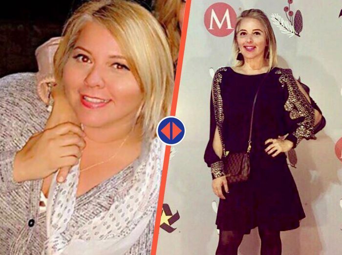 resultados de clinica para la obesidad en Monterrey 1