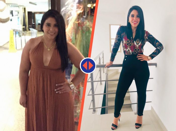 resultados de clinica para la obesidad en Monterrey